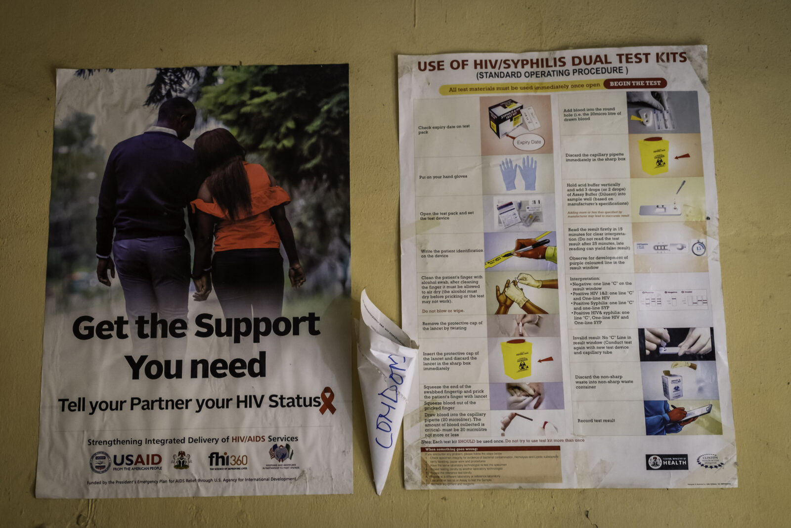 HIV and syphilis testing and treatment signs in Primary Health Centre, Base Uyo Akwa Ibom State, Nigeria
