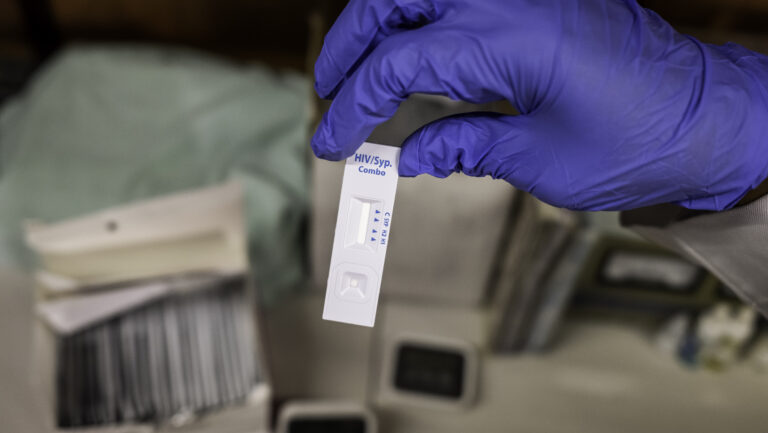 The dual test for HIV and syphilis requires a single finger-prick blood sample and gives results in 20 minutes