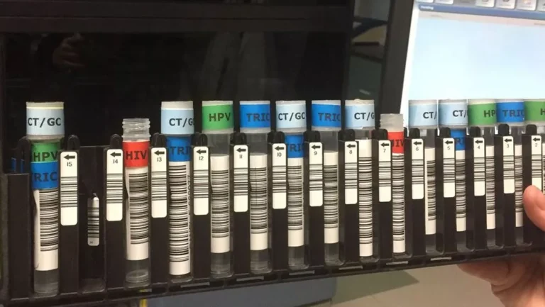 A row of HIV tests