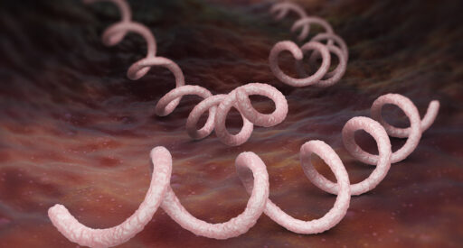 Syphilis is a sexually transmitted infection caused by the spirochete bacterium